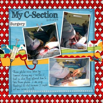 My C-Section