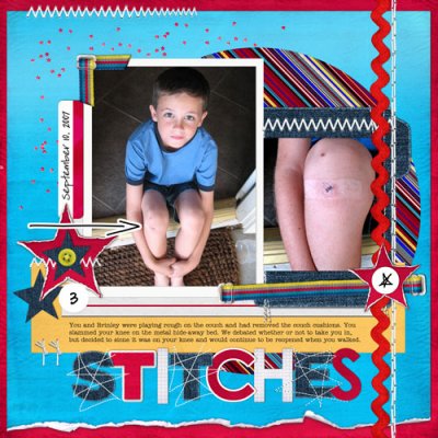 Stitches