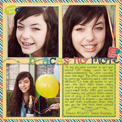 Braces-no-more