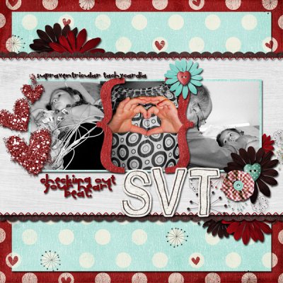 SVT