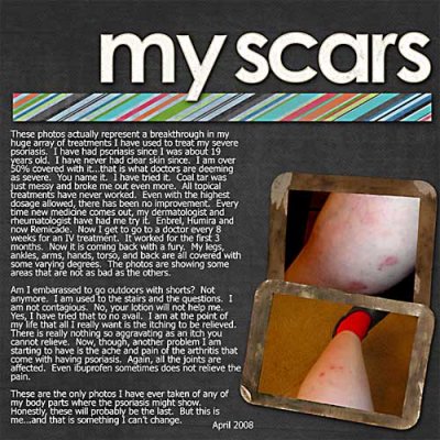 Sugar Free Challenge #41 - My Scars