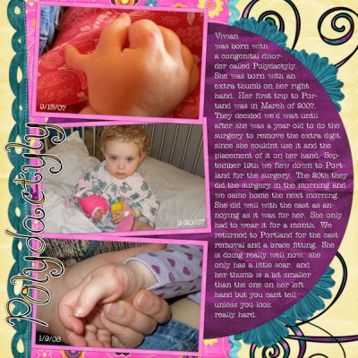 Polydactyly