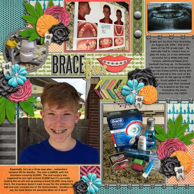 Braces