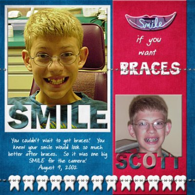 SMILE if you want braces