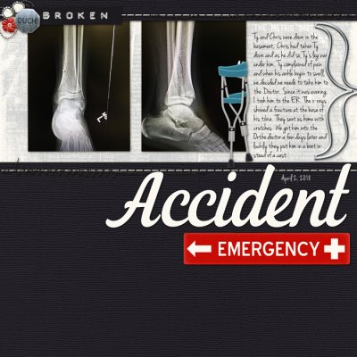 Broken Leg