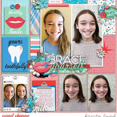 2022 Braces