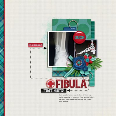 fibula