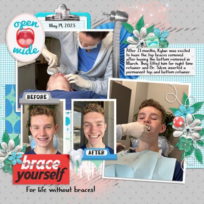 Kylan600-braces-removed-Tinci_MM20_3