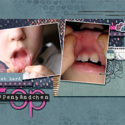 tooth surgery