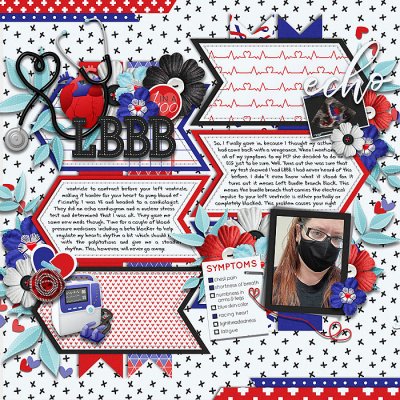 LBBB