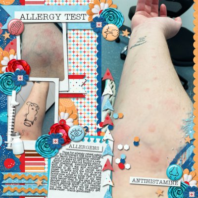 Allergy Testing