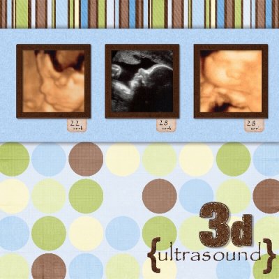 Colby ultrasound