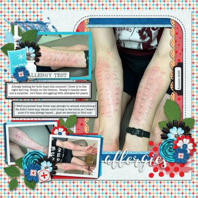 Allergy testing