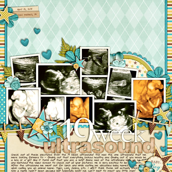 19 Week Ultrasound