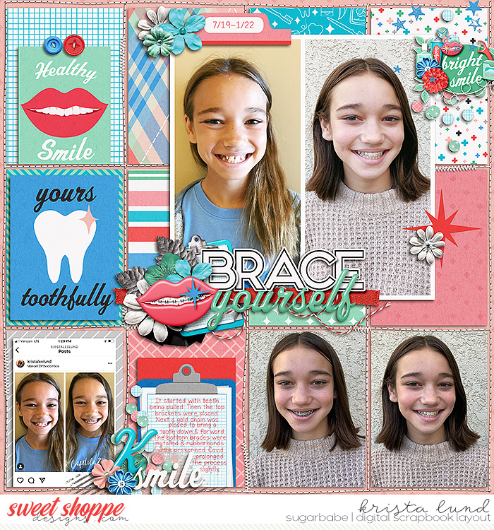 2022 Braces
