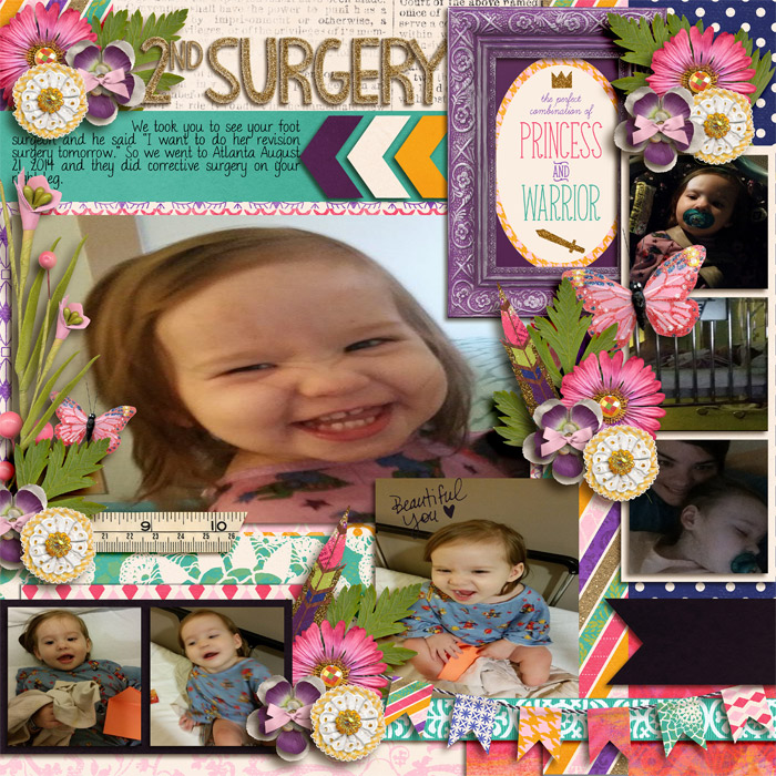 2nd Surgery