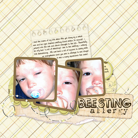 BEE STING allergy