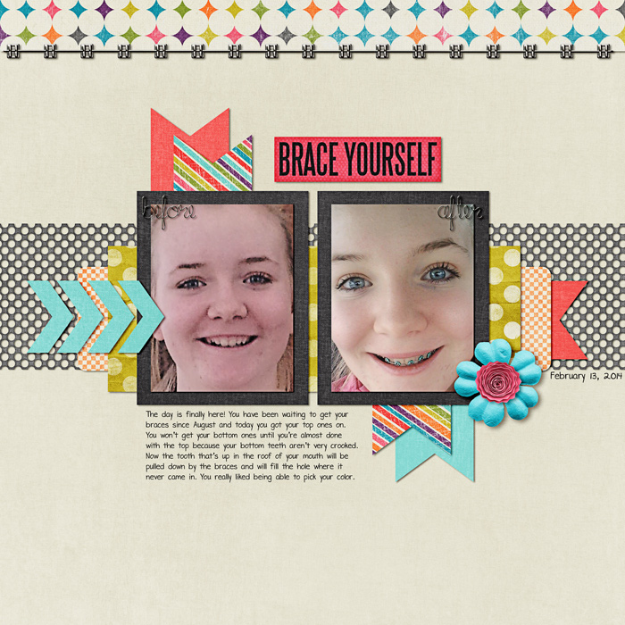 Brace Face - N10 challenge