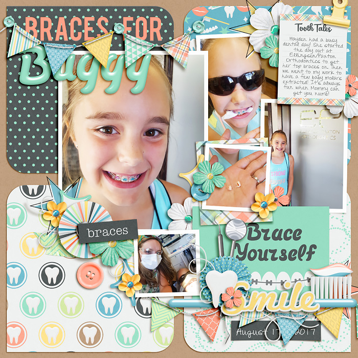 Braces For Buggy