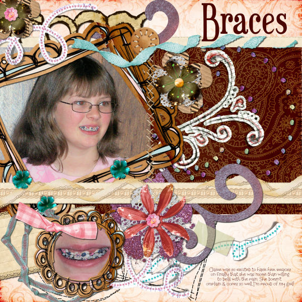Braces