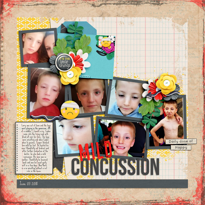 Concussion 18