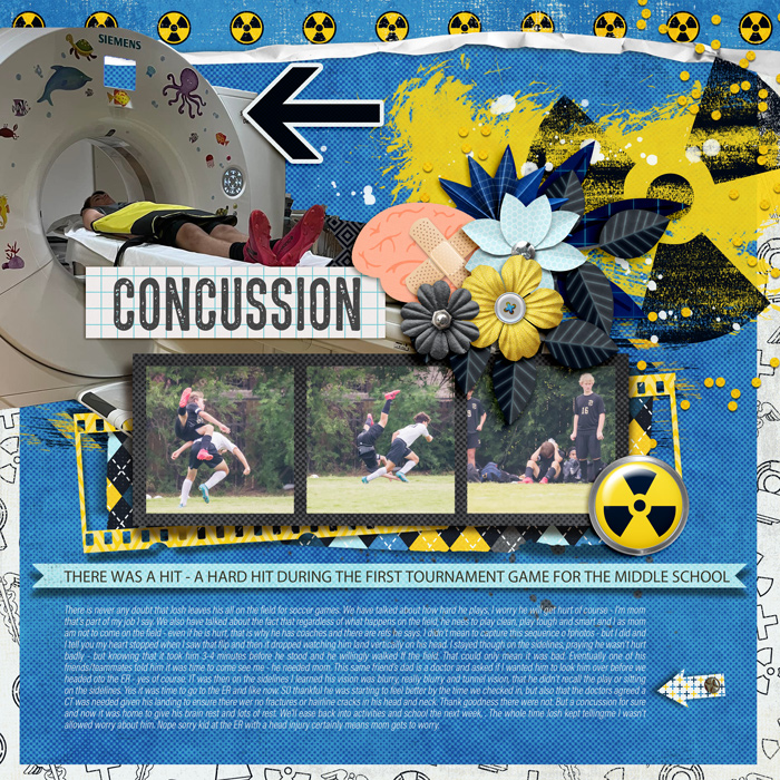 Concussion