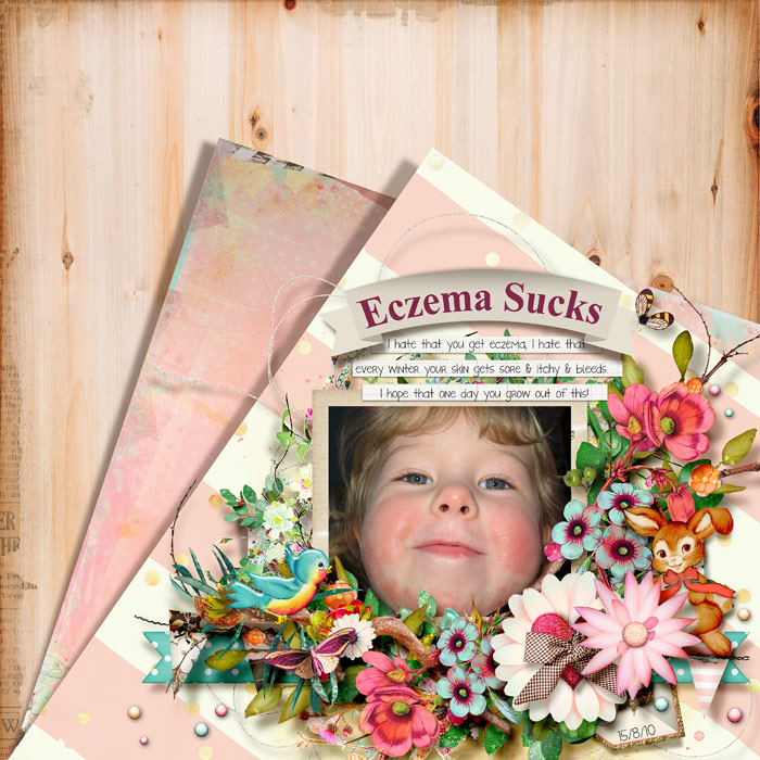 Eczema Sucks