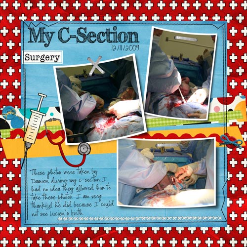 My C-Section