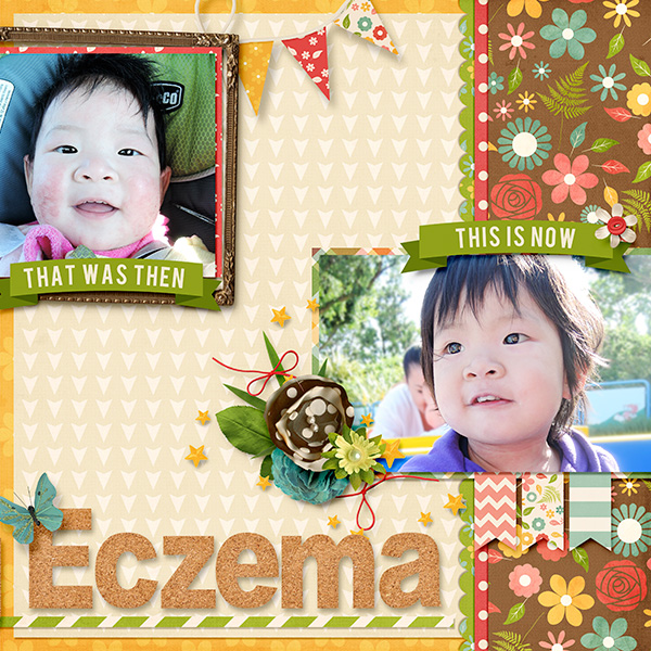 Overcoming Eczema Right
