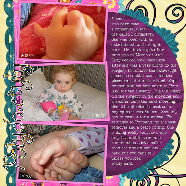 Polydactyly
