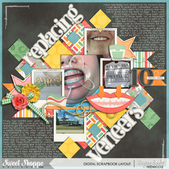 replacing veneers