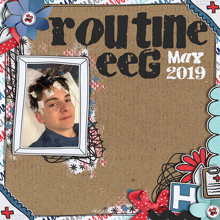 Routine EEG