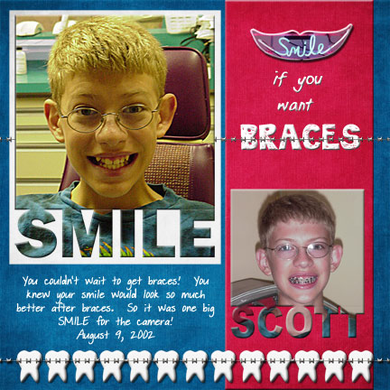 SMILE if you want braces