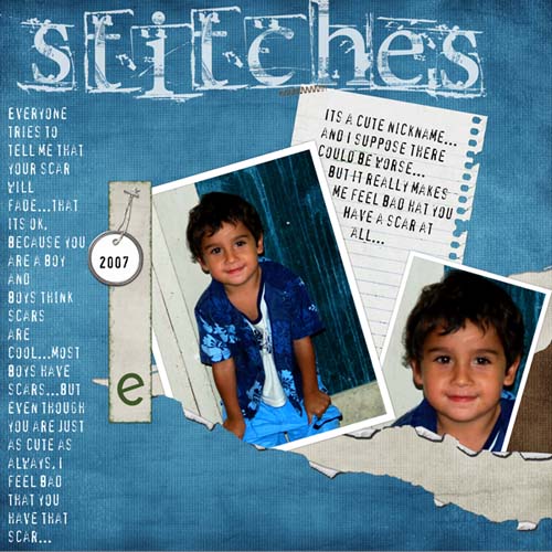 Stitches