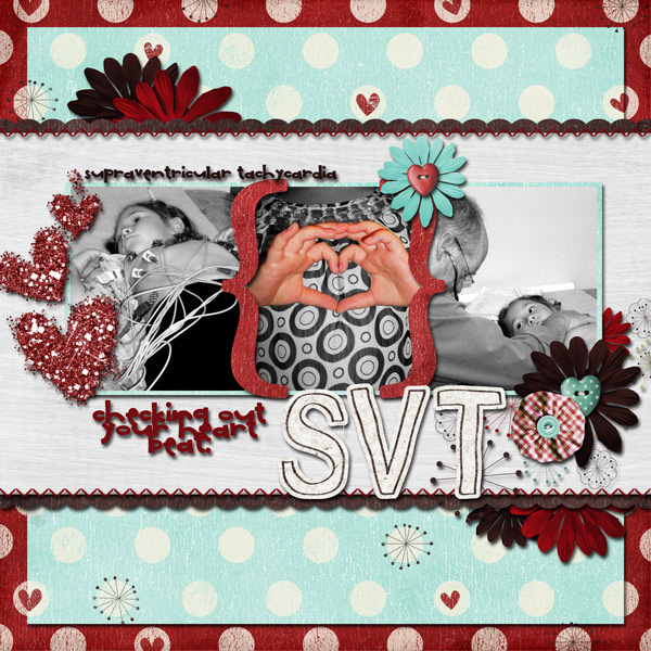 SVT