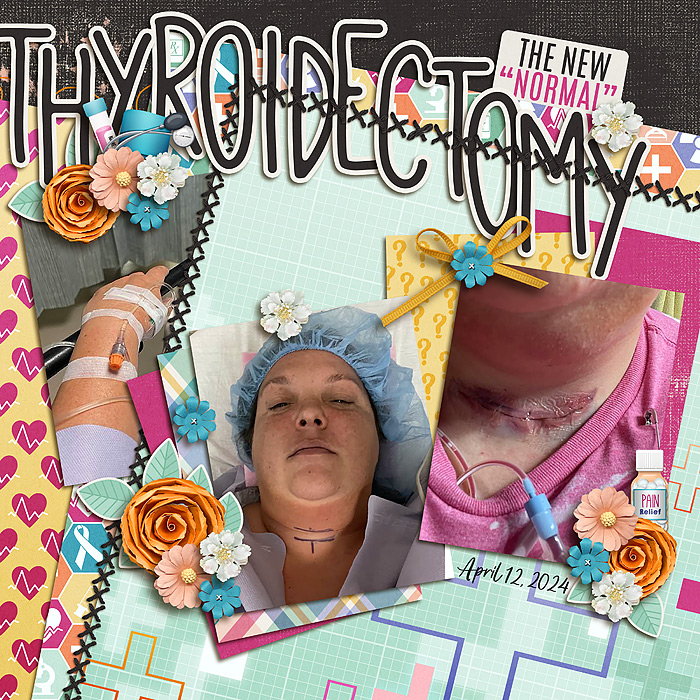 Thyroidectomy