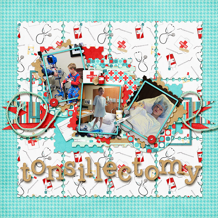 Tonsillectomy