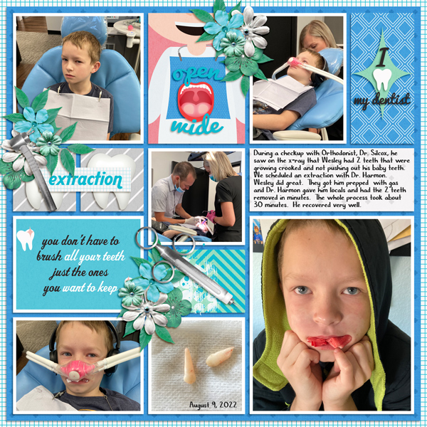Tooth Extractions