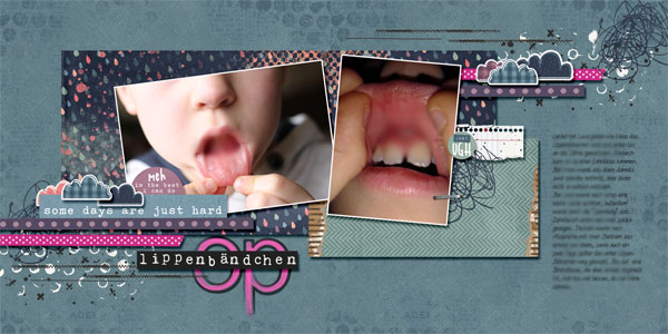tooth surgery