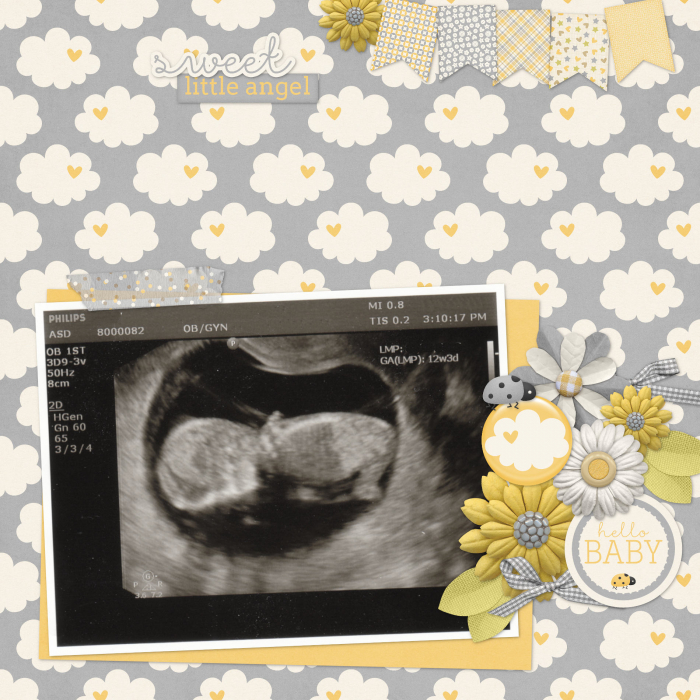 Ultrasound