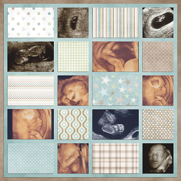 ultrasoundright-copy